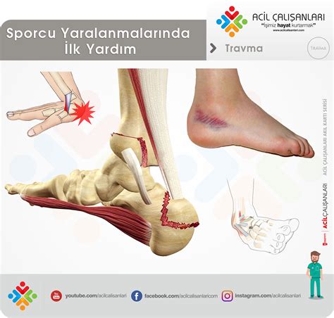 Spor Yaralanmalarında İlk Yardım